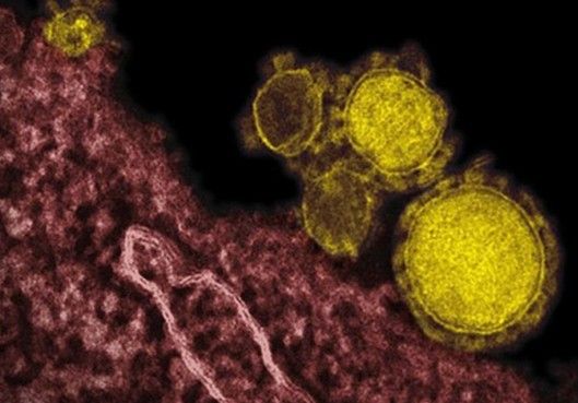 专家称类SARS新型病毒易在医院环境中传播